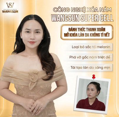 Phòng Khám Xóa Nám Uy Tín Tại TP.HCM: Cách Nhận Biết Và Lựa Chọn Đúng Ngay Từ Đầu xóa nám da công nghệ cao