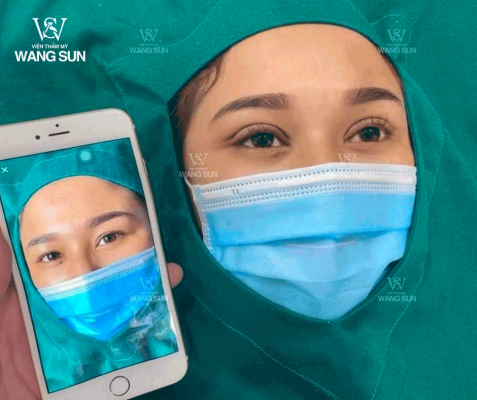 Cắt mí phượng hoàng