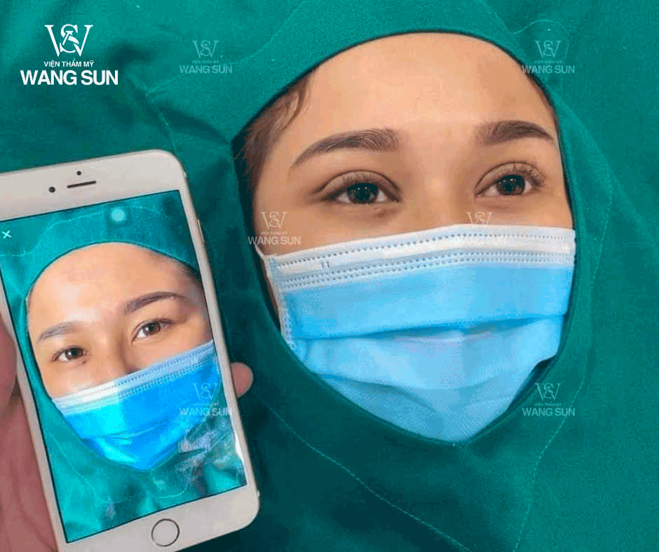 Top 7 Công Nghệ Và Phương Pháp Khắc Phục Đôi Mắt Buồn Được Quan Tâm Hiện Nay Cắt mí phượng hoàng
