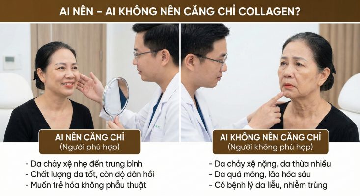 Căng chỉ collagen: Hiểu đúng trước khi quyết định trẻ hóa da không phẫu thuật Ai nên và không nên căng chỉ collagen