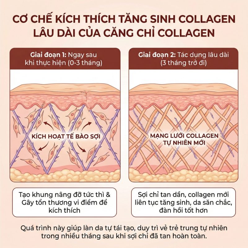 Căng chỉ collagen: Hiểu đúng trước khi quyết định trẻ hóa da không phẫu thuật Cơ chế kích thích tăng sinh collagen lâu dài của căng chỉ collagen