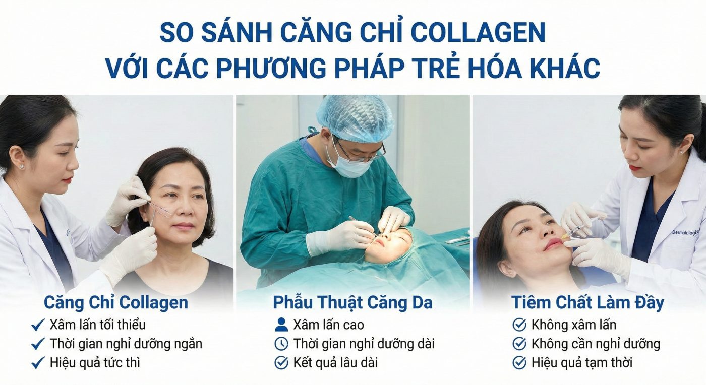 Căng chỉ collagen: Hiểu đúng trước khi quyết định trẻ hóa da không phẫu thuật So sánh căng chỉ collagen với phương pháp trẻ hóa khác