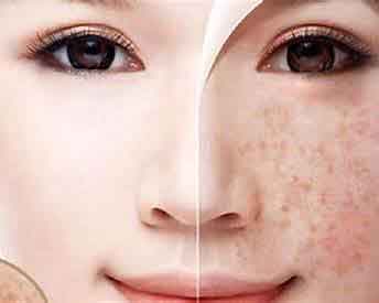 Phòng Khám Xóa Nám Uy Tín Tại TP.HCM: Cách Nhận Biết Và Lựa Chọn Đúng Ngay Từ Đầu Vì sao nên xóa nám tại Phòng khám Wangsun TP.HCM?