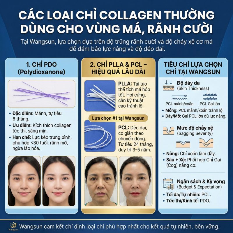 Các loại chỉ collagen vùng má rãnh cười
