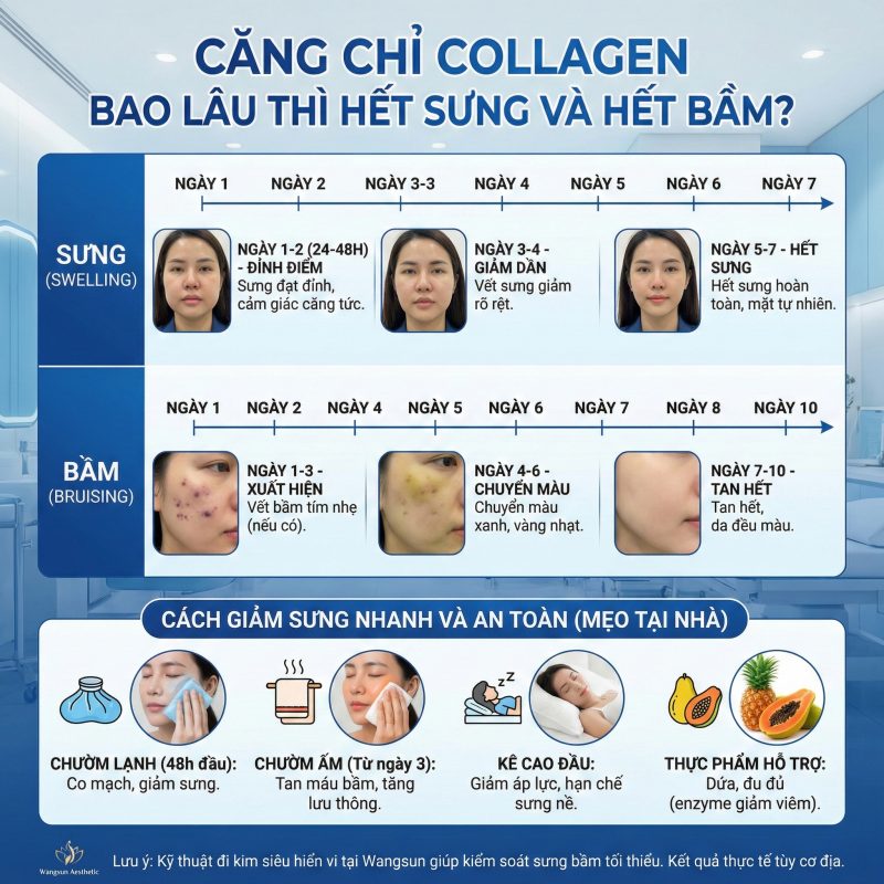 Căng chỉ collagen bao lâu thì hết sưng hết bầm