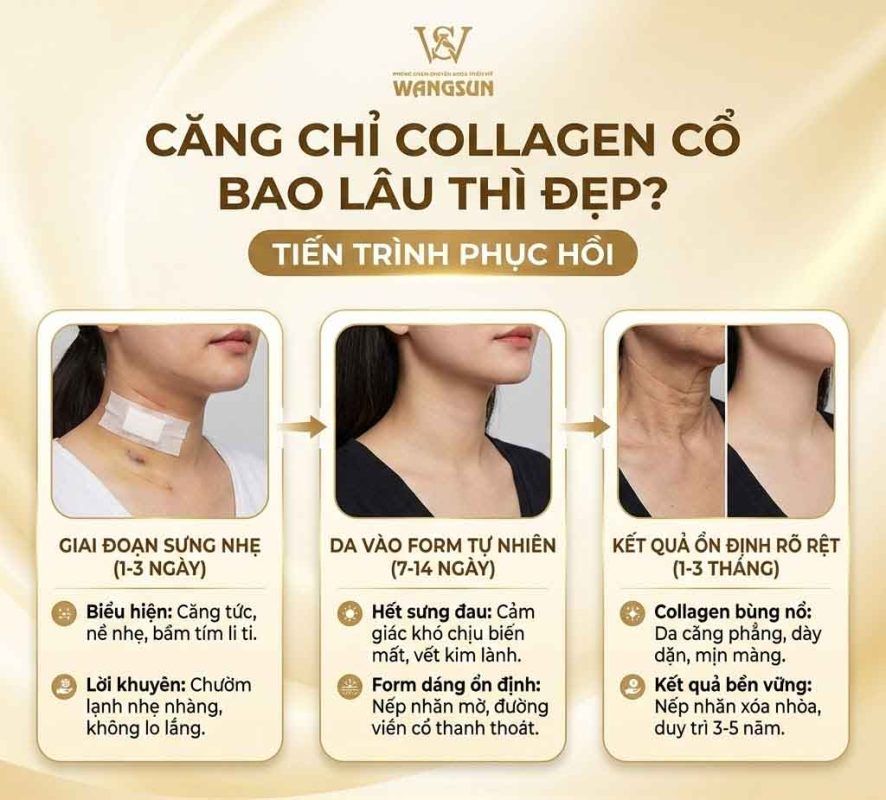 Căng chỉ collagen vùng cổ bao lâu thì đẹp