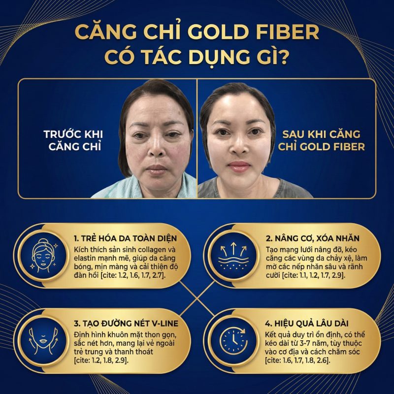Căng Chỉ Collagen Gold Fiber - Giải Mã Công Nghệ "Chỉ Lai Vàng" Căng chỉ gold fiber có tác dụng gì