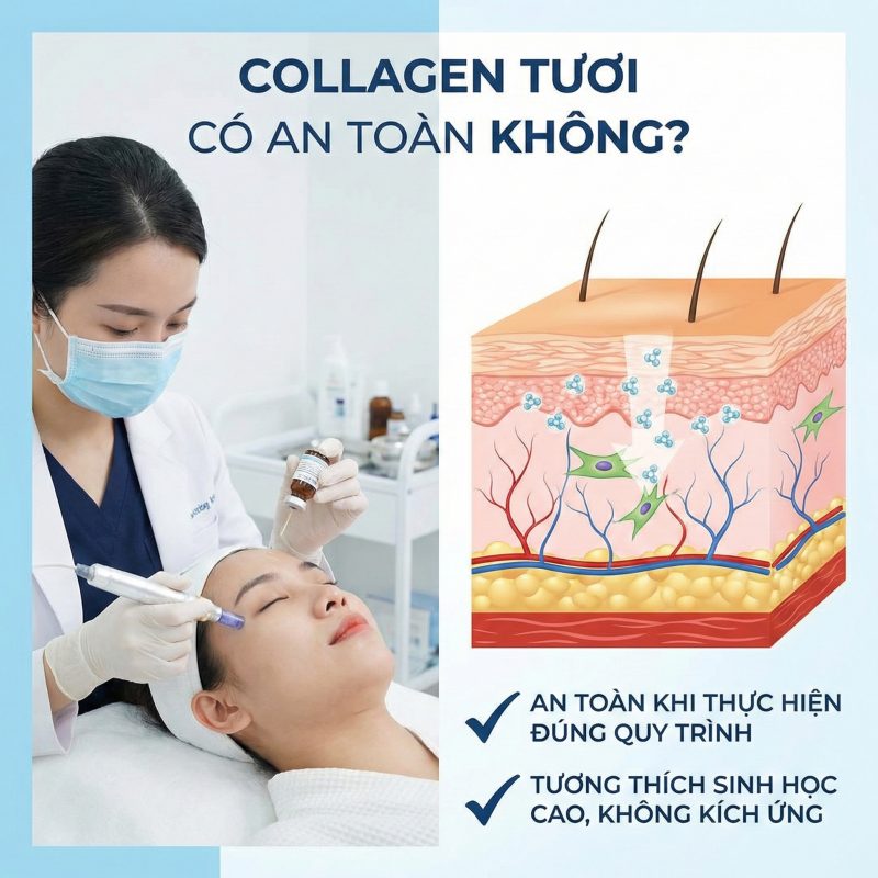Cấy Collagen Tươi Là Gì? Giải Thích Toàn Diện Từ A–Z (Cập Nhật 2026) Cấy Collagen tươi có an toàn không