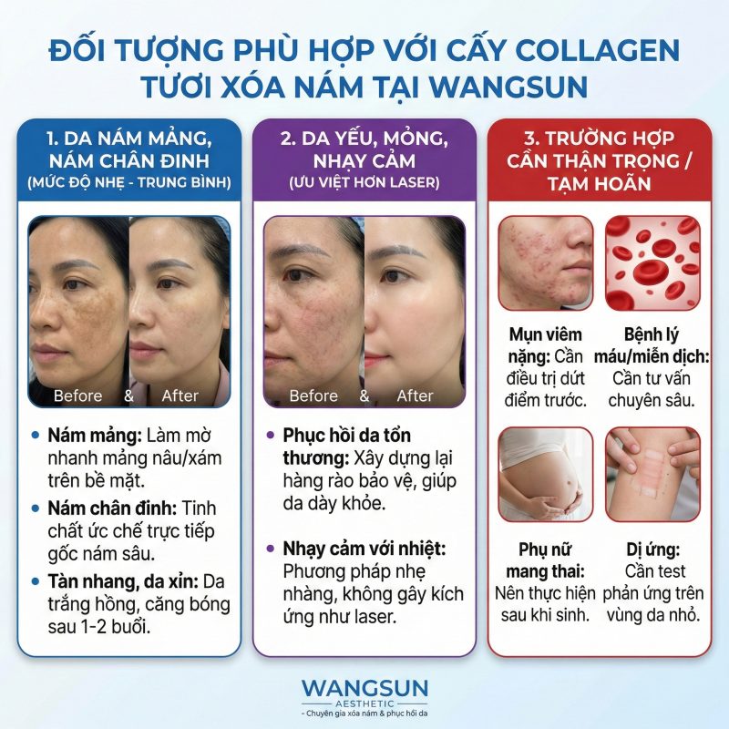 Đối tượng phù hợp cấy collagen tươi xóa nám