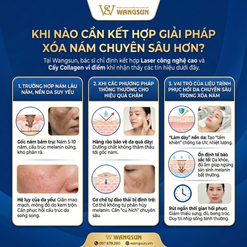 Khi nào cần kết hợp giải pháp chuyên sâu xóa nám 