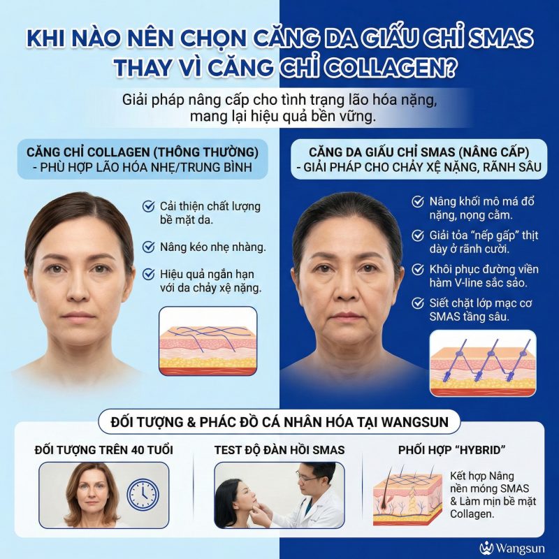 Khi nào nên chọn căng da giấu chỉ smas thay vì căng chỉ collagen