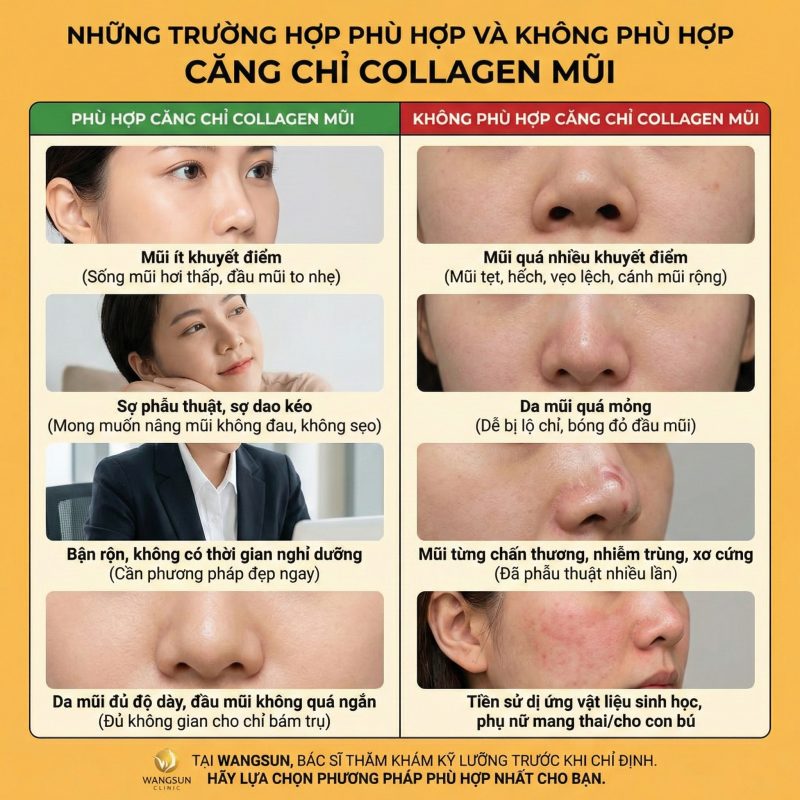 Những trường hợp hợp và không phù hợp căng chỉ collagen nâng mũi