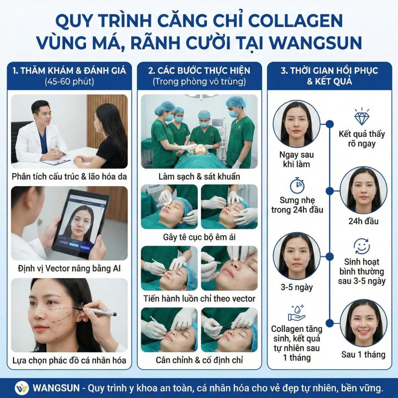 Quy trình căng chỉ collagen vùng má rãnh cười