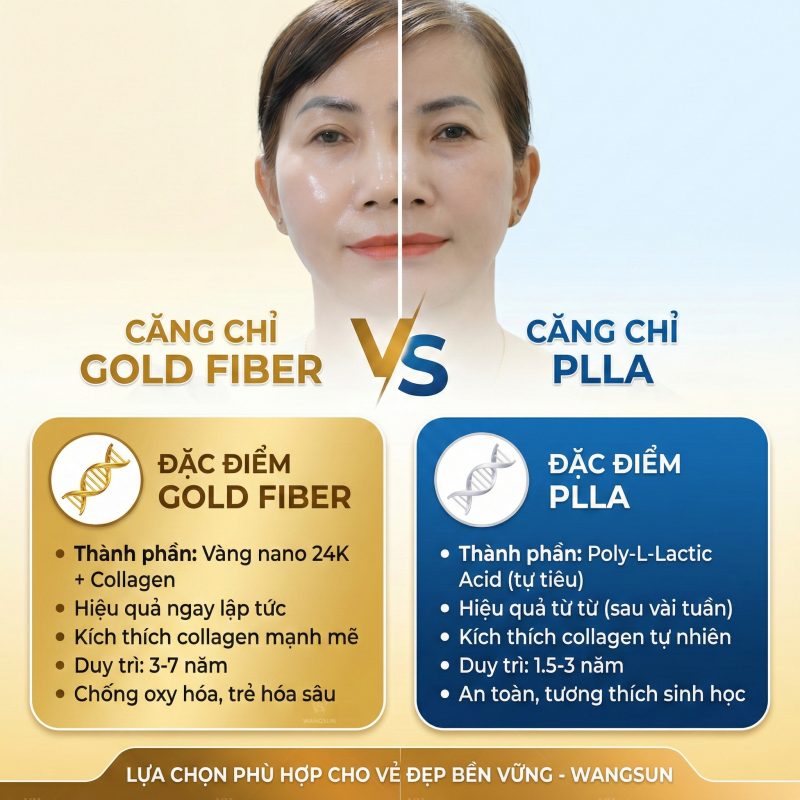 Căng Chỉ Collagen Gold Fiber - Giải Mã Công Nghệ "Chỉ Lai Vàng" So sánh căng chỉ gold fiber với plla