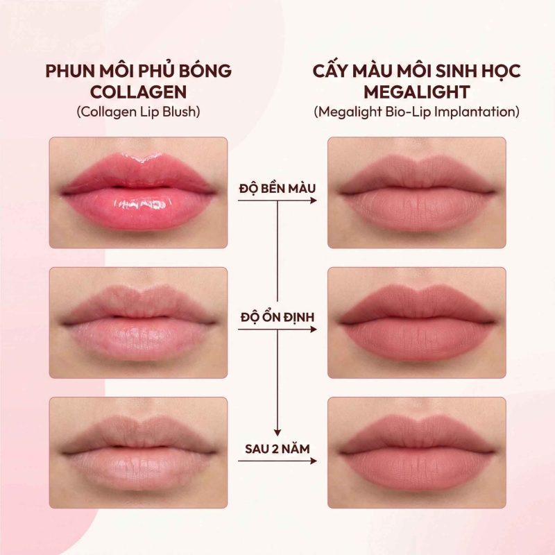 So sánh phun môi phủ bóng collagen và cấy màu mô sinh học megalight về độ ổn định và độ bền màu
