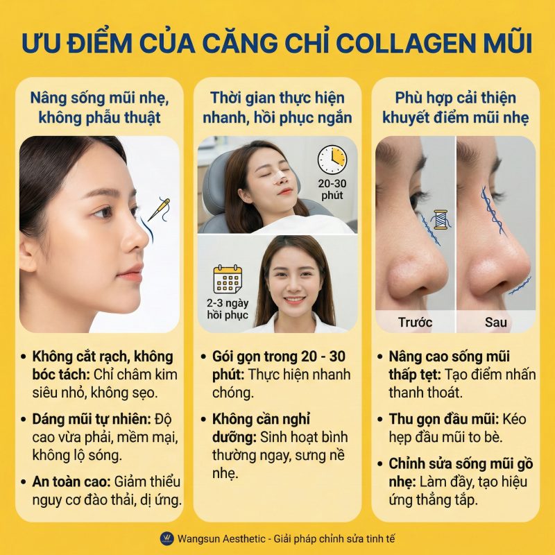 Ưu điểm của căng chỉ collagen nâng mũi