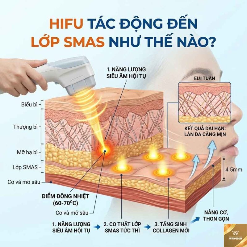 Khám Phá Cơ Chế Nâng Cơ HIFU Không Phẫu Thuật Hifu tác động đến lớp Smas như thế nào
