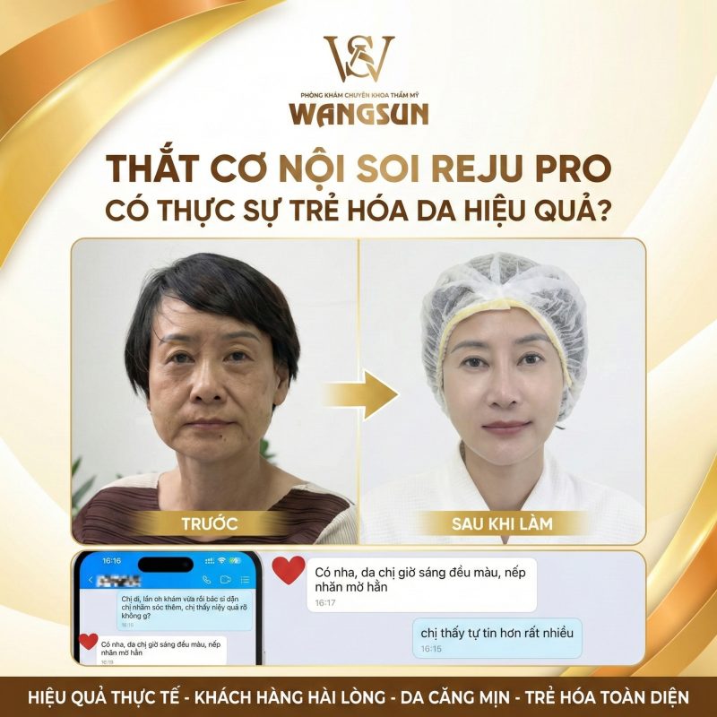 Thắt cơ nội soi Reju Pro là gì? Khác gì nâng cơ nội soi? Thắt cơ nội soi Reju Pro có thật sự trẻ hóa da