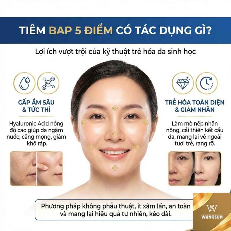 Tiêm BAP 5 điểm có tác dụng gì