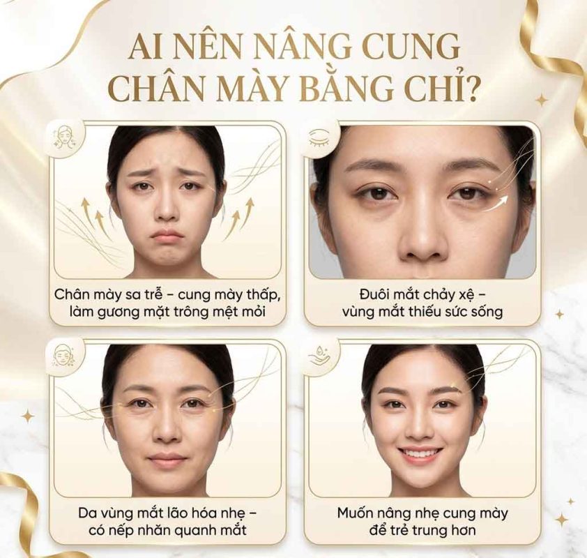 Nâng Cung Chân Mày Bằng Chỉ Là Gì? Ai nên nâng cung chân mày bằng chỉ
