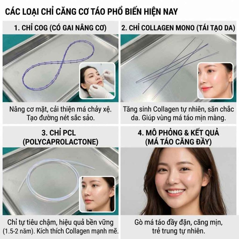 Các loại chỉ nâng cơ táo phổ biến hiện nay