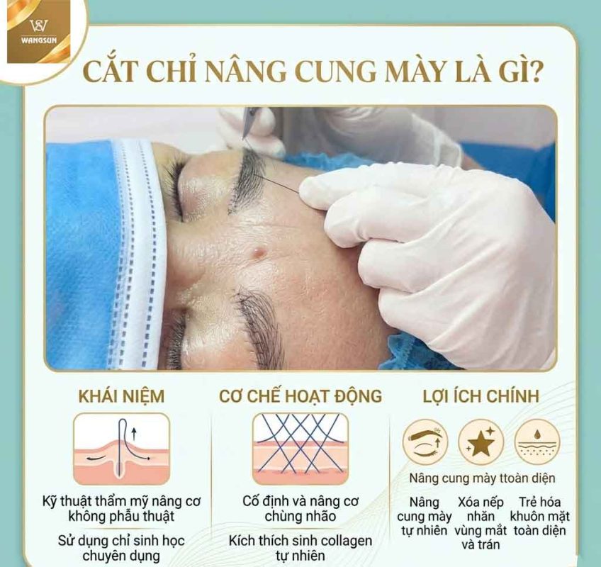 Cắt chỉ nâng cung chân mày là gì