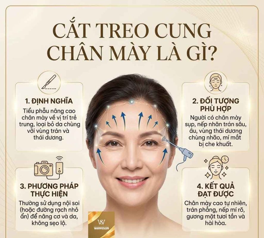 Cắt treo cung chân mày là gì