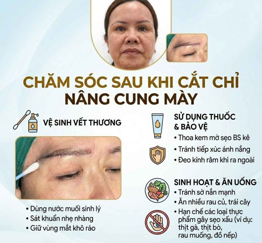 Chăm sóc sau khi cắt chỉ nâng cung chân mày
