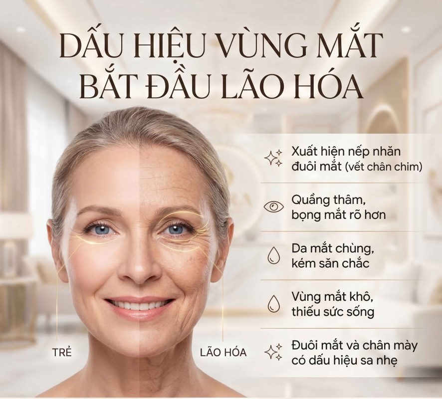 Dấu hiệu vùng mắt bắt đầu lão hóa