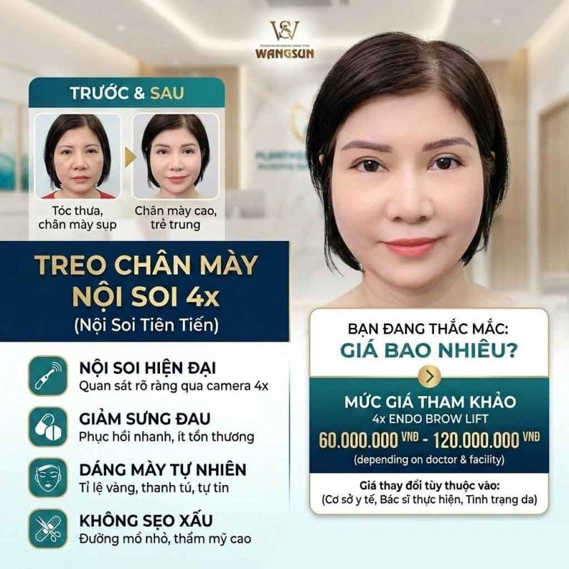 Treo Chân Mày Nội Soi 4X Giá Bao Nhiêu?