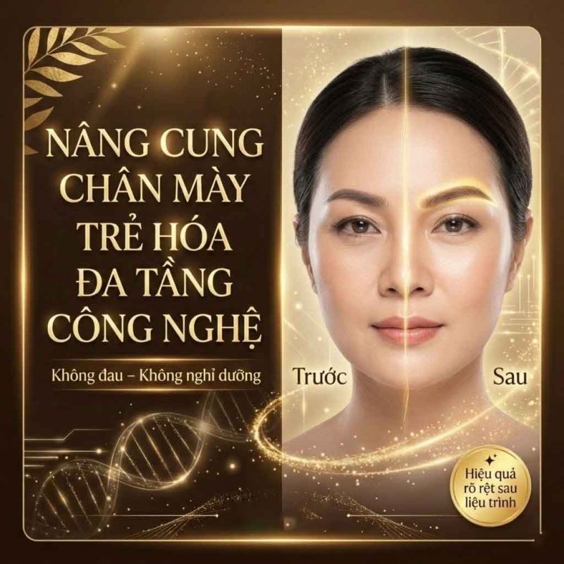 Nâng Cung Chân Mày Bao Lâu Thì Hết Sưng?