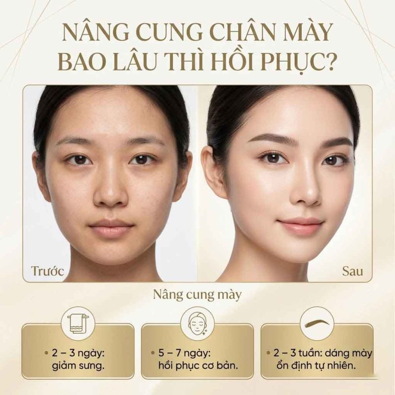 Nâng cung chân mày bao lâu thì hồi phục