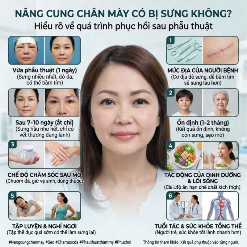 nâng cung chân mày bao lâu thì hết sưng