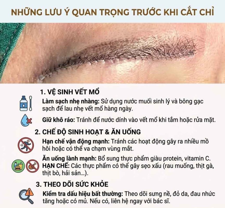Những lưu ý quan trọng trước khi cắt chỉ