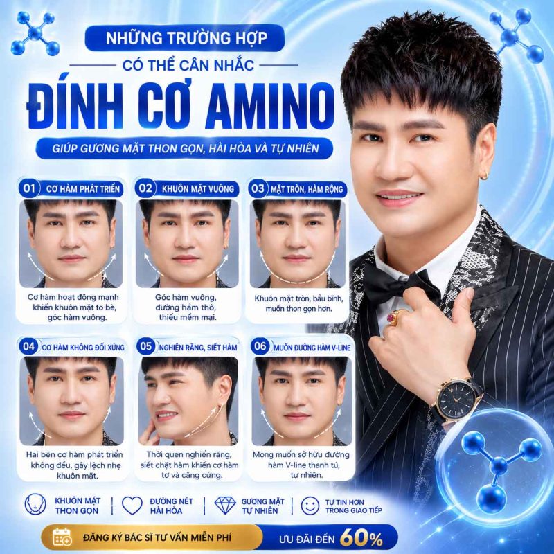 Những trường hợp nên cân nhắc đính cơ amino