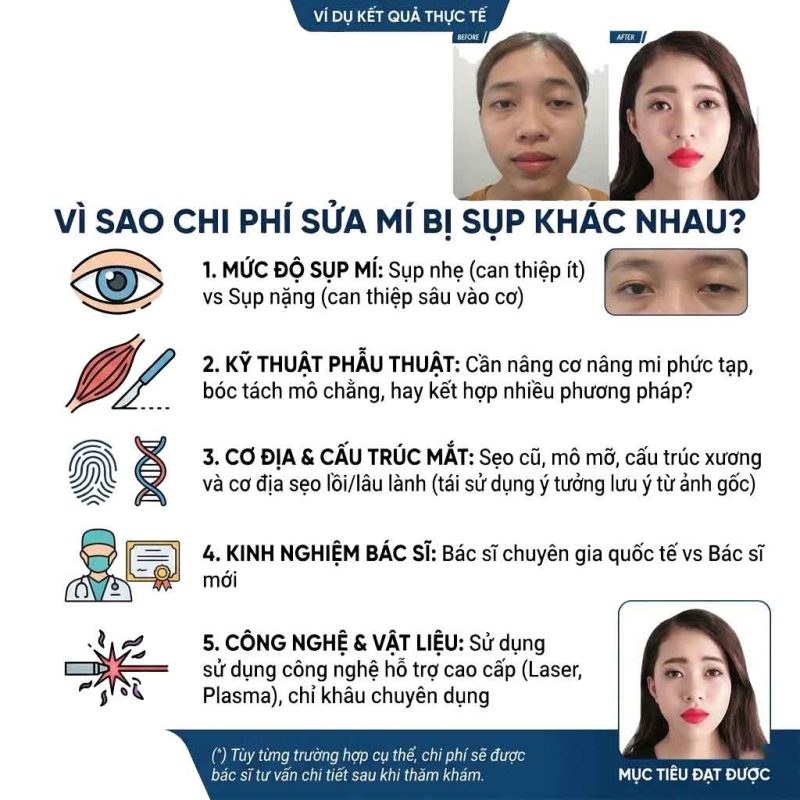 Vì sao chi phí sửa mí mắt bị sụp khác nhau