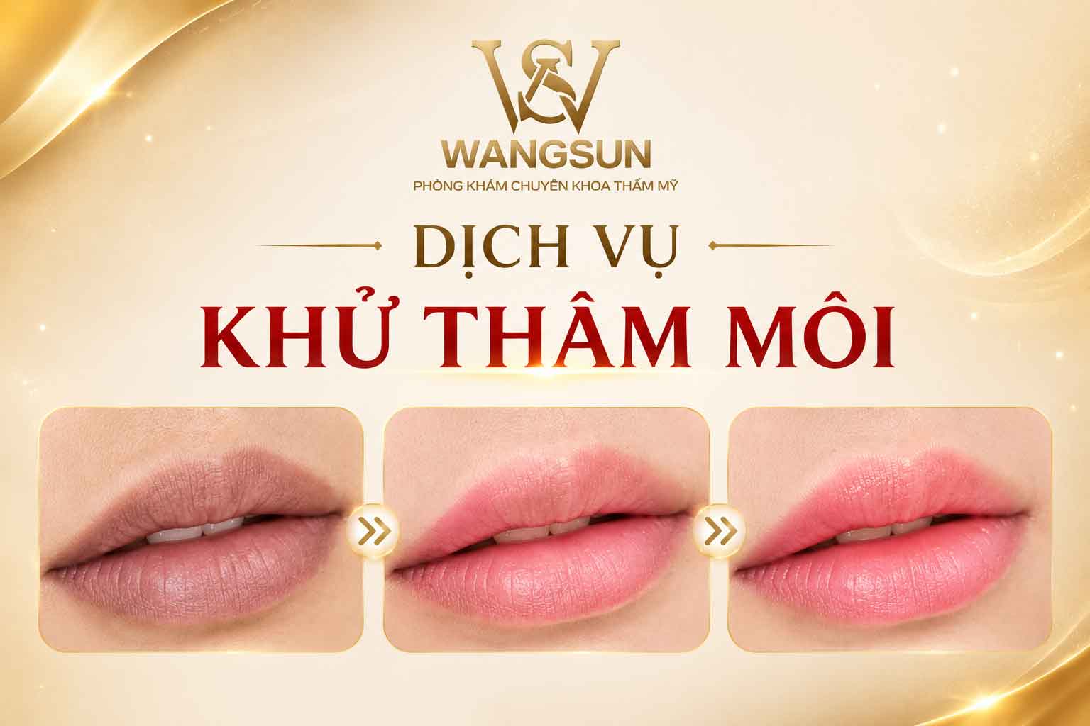 Dịch vụ khử thâm môi WangSun Luxury