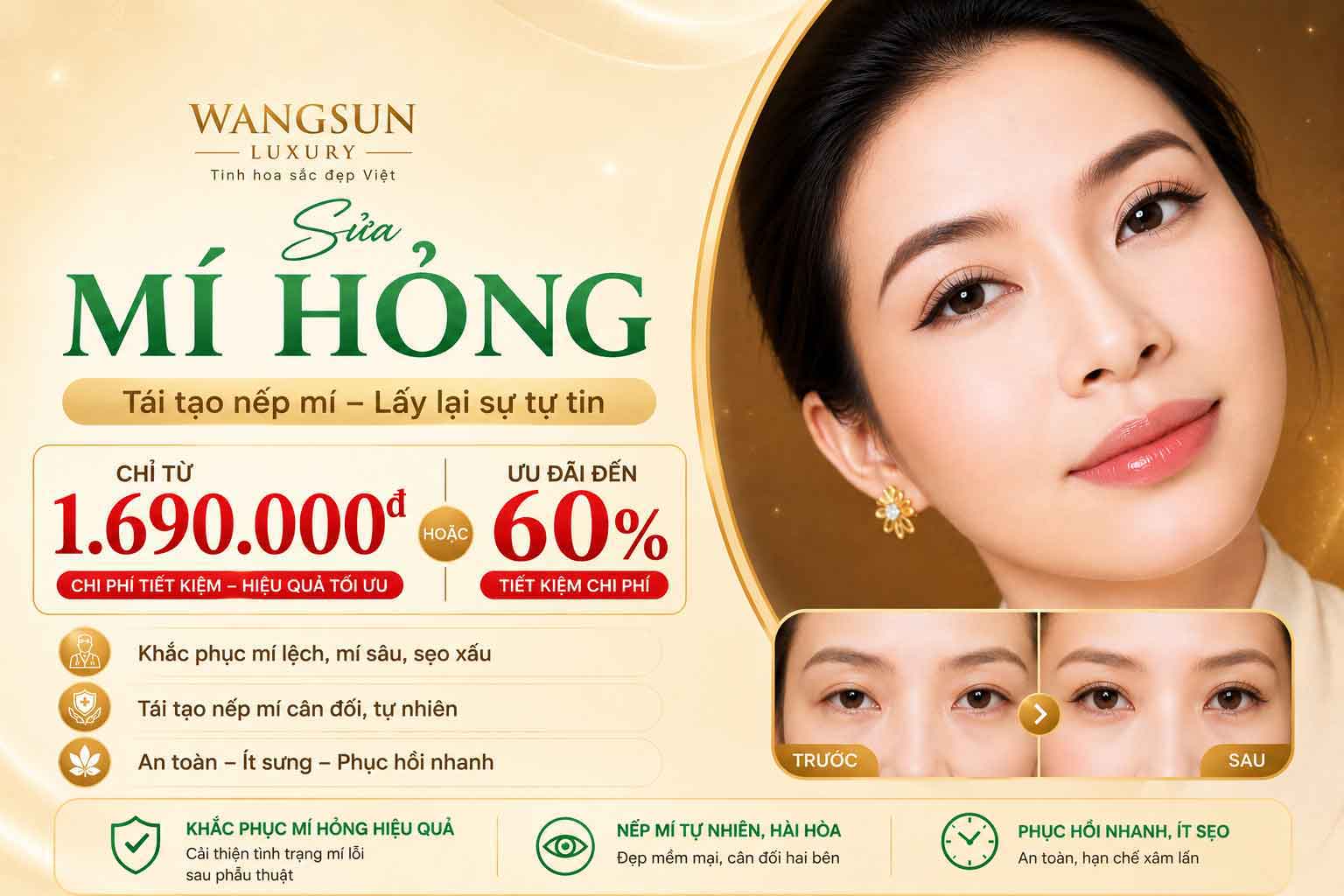 Sửa mí hỏng WangSun Luxury