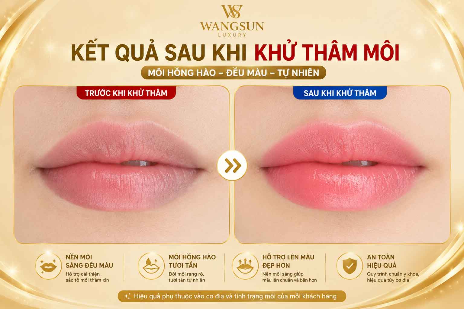 Khử thâm môi