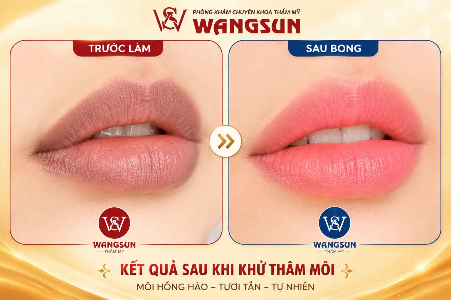 Khử thâm môi
