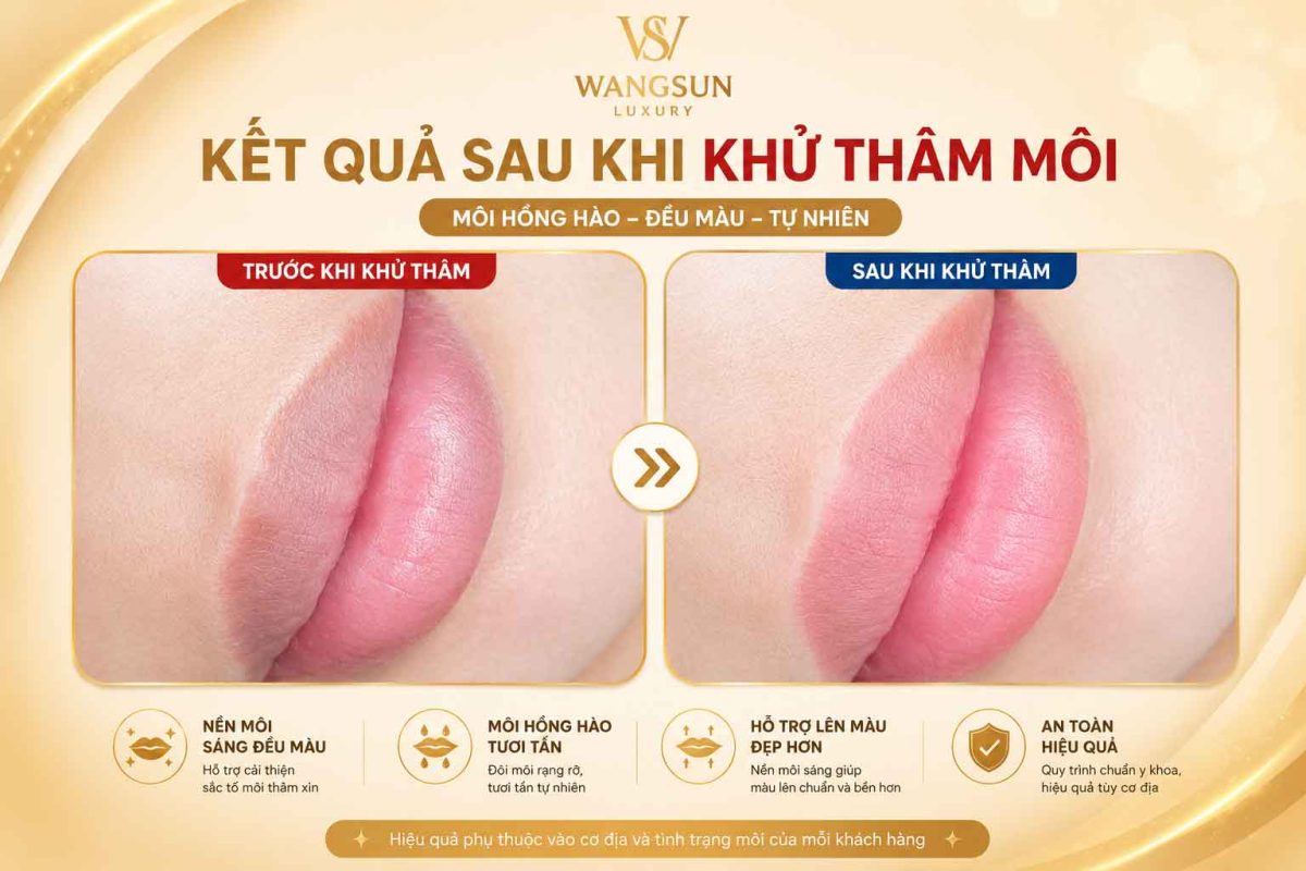 Ai phù hợp 10 công nghệ khử thâm môi tại thẩm mỹ viện hiện nay Trước sau khử thâm môi