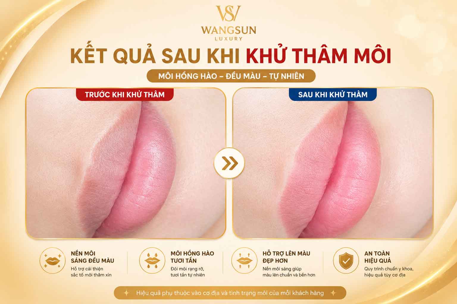 Khử thâm môi