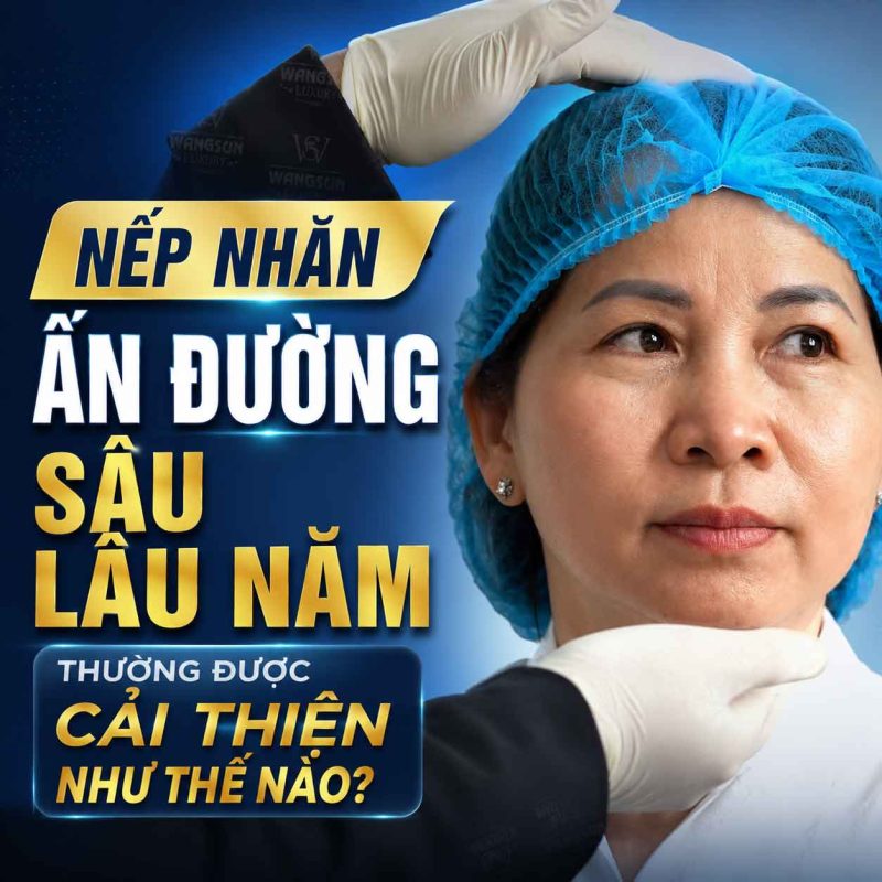 Nếp Nhăn Ấn Đường Sâu Lâu Năm Có Xóa Được Không? Các phương pháp cải thiện Nếp nhăn ấn đường sâu lâu năm cải thiện như thế nào