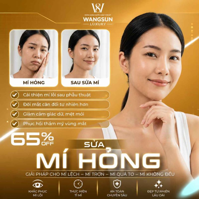 Sửa Mí Hỏng
