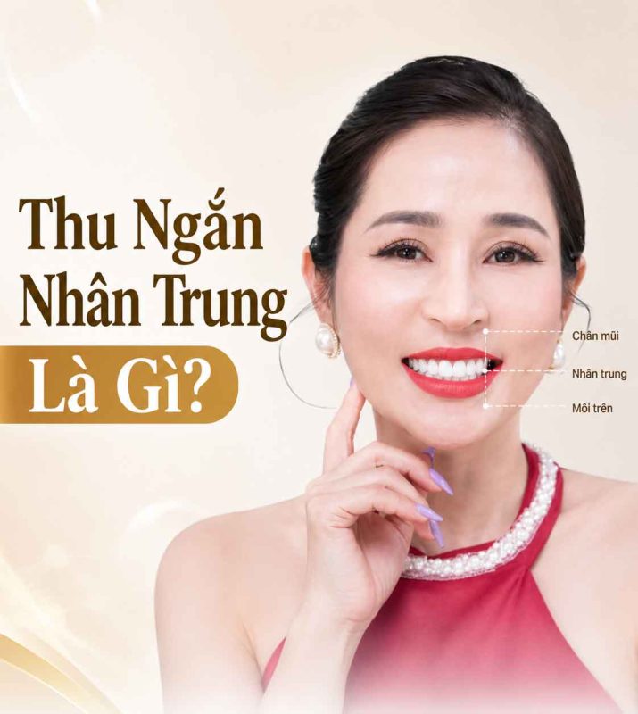 Thu ngắn nhân trung là gì