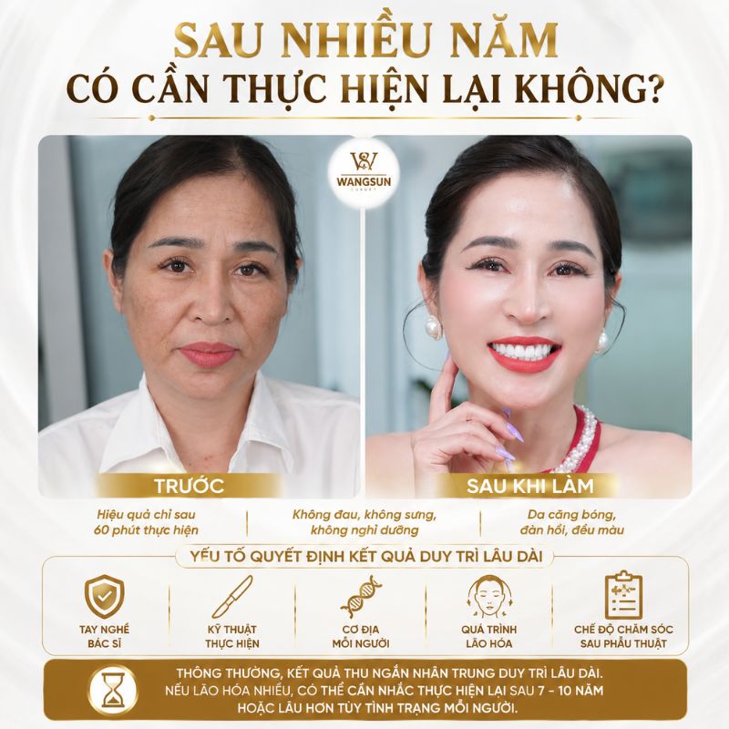 Thu Ngắn Nhân Trung Bằng Chỉ Có Thật Sự Hiệu Quả Không? Thu ngắn nhân trung sau nhiều năm có thực hiện lại không