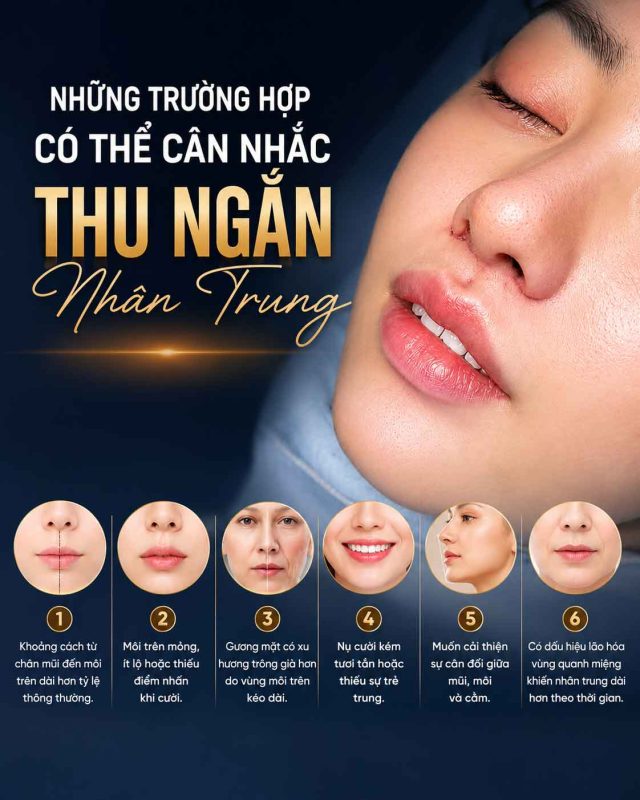 Có Nên Thu Ngắn Nhân Trung Không? Khi Nào Nên Cân Nhắc Cải Thiện? Trường hợp nên cân nhắc thu ngắn nhân trung