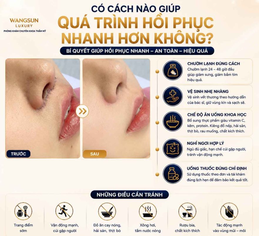 Thu Ngắn Nhân Trung Bao Lâu Thì Hồi Phục? Thời Gian Lành Thương Và Những Điều Cần Biết Có Cách Nào Giúp Quá Trình Hồi Phục Nhanh Hơn Không?