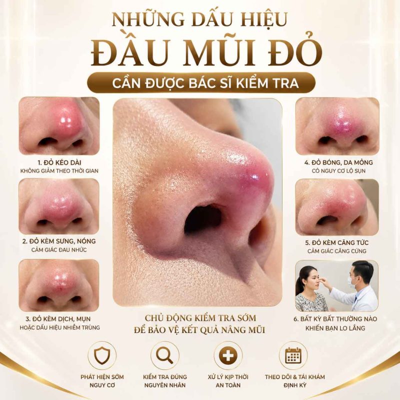 Đầu mũi đỏ có phải dấu hiệu sắp lộ sụn không Những dấu hiệu đầu mũi đỏ