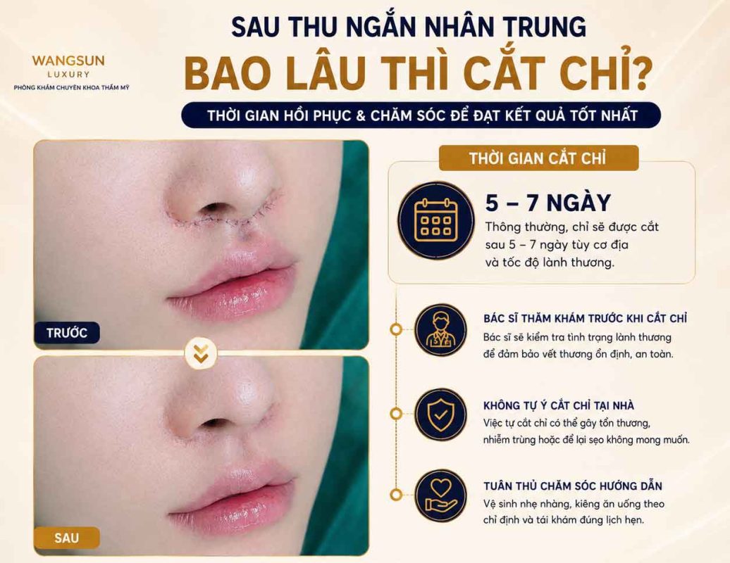Thu Ngắn Nhân Trung Bao Lâu Thì Hồi Phục? Thời Gian Lành Thương Và Những Điều Cần Biết Sau thu ngắn nhân trung bao lâu thì có thể cắt chỉ